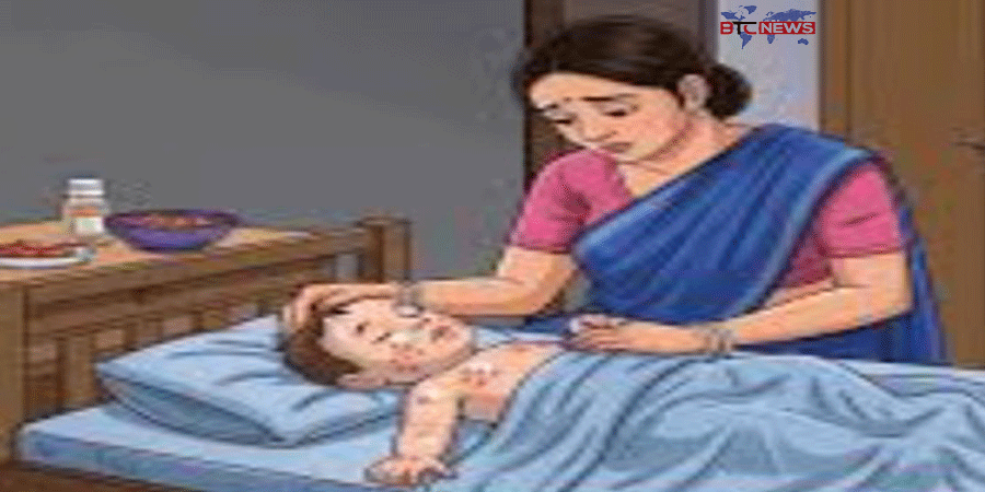 খুলনা বিভাগে হামের প্রাদুর্ভাব: গত এক মাসে আক্রান্ত সহস্রাধিক, মৃত্যু-১০