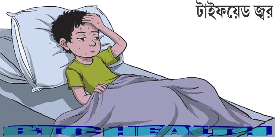 যে সব কারণে টাইফয়েড জ্বর বিপজ্জনক, করণীয় কী?