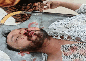 রাজশাহী নগরীতে যুবককে পিটিয়ে জখম, থানায় অভিযোগ