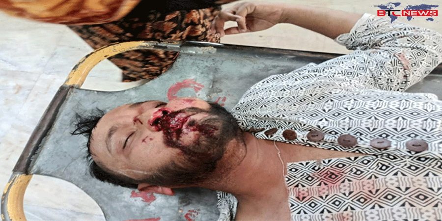 রাজশাহী নগরীতে যুবককে পিটিয়ে জখম, থানায় অভিযোগ